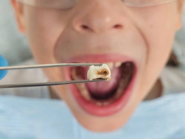  Richmond Hill, GA Emergency Dentist Pros