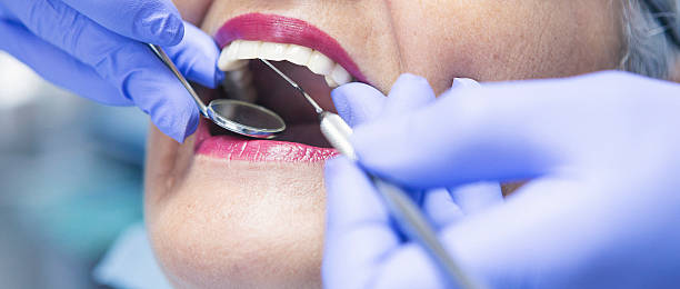 Best Emergency Tooth Extraction in Richmond Hill, GA